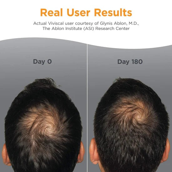 Viviscal Men's Hair Growth Supplements for Thicker Fuller Hair, Clinically Proven Collagen Complex