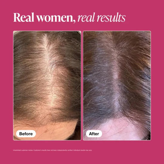 Viviscal Hair Growth Supplements for Women, Thicker Fuller Hair Support for Thinning Hair and Hair Loss, with Biotin and Marine Collagen, Drug-Free